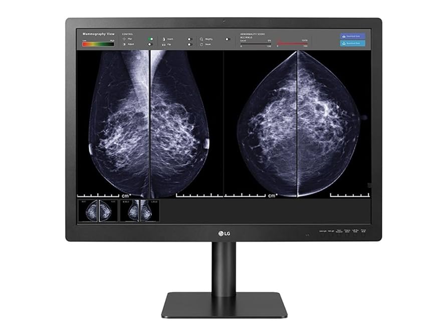 Amazon.com: LG 31IN Medical Anti-Glare, 3H DIGNOSTIC Monitor